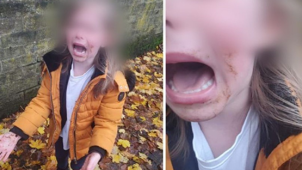 一名女童跌倒「吃狗屎」，當場崩潰大哭。（圖／翻攝自Yorkshire Live）