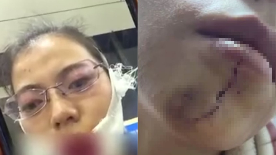 女子臉被毆成重傷。（圖／翻攝自微博）