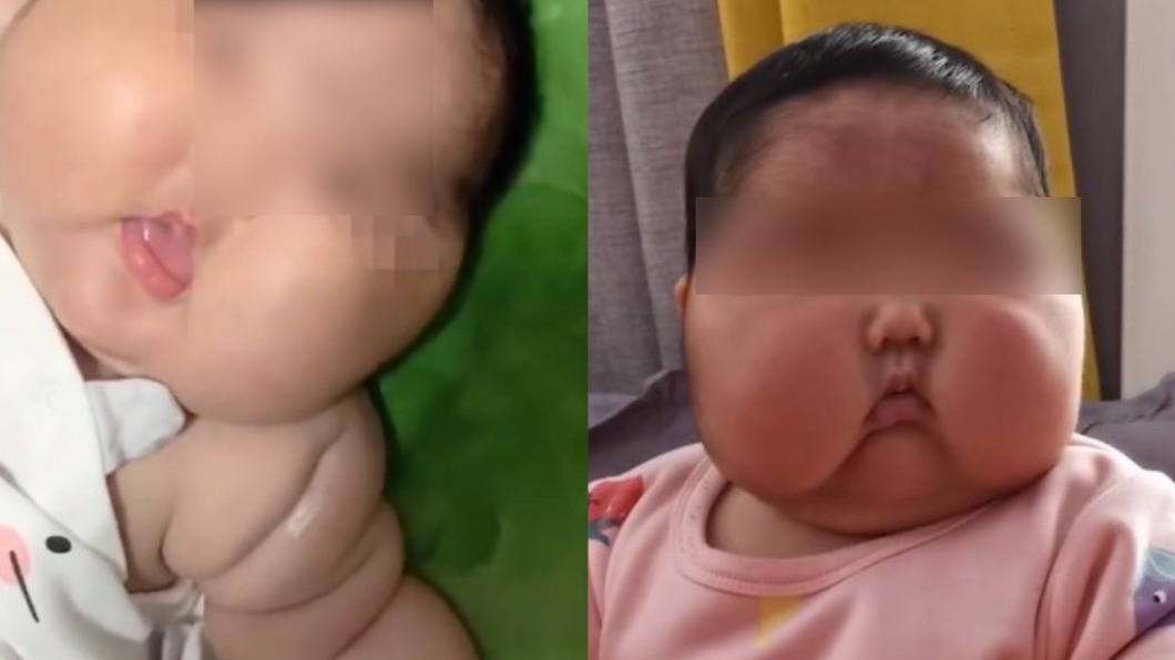 （圖／翻攝自微博） 5月嬰飆胖11kg成「大頭娃娃」　疑黑心嬰兒霜釀禍