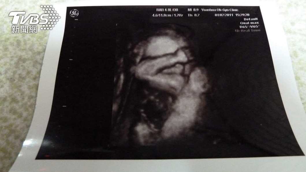 一名張姓人父分享自己兒子的超音波照，胎兒似乎在媽媽的肚子內做仰臥起坐。（圖／張姓網友授權提供）