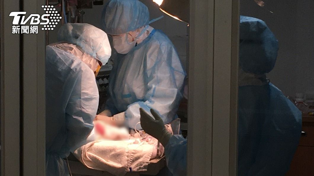 慈濟醫院一名確診孕婦插管剖腹生產。（圖／台北慈濟醫院提供）