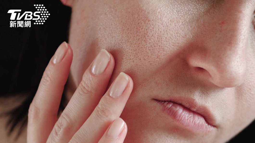 毛孔粗大是最多人在意的皮膚問題。（示意圖／shutterstock達志影像）