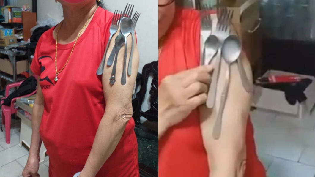 婦人手臂吸附白鐵餐具。（圖／翻攝自汐止集團Facebook）