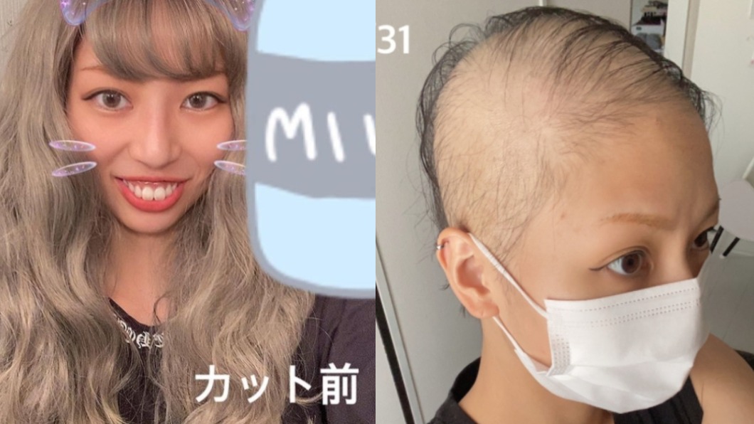 一名日本女子打完莫德納後出現嚴重掉髮，只好買假髮佩戴。（圖／翻攝自ayapipipiii IG、Ameba）