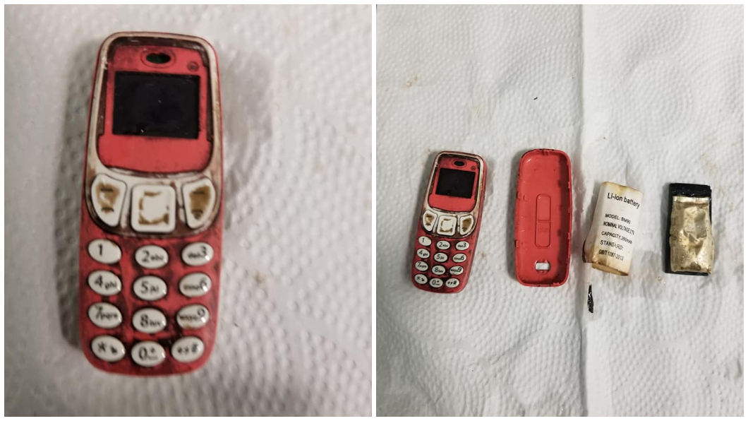 科索沃一名男子不知什麼原因把Nokia 3310吞下肚。（圖／翻攝自Skender Telaku臉書）