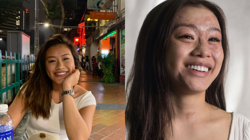新加坡23歲網紅莎琳分享自己的故事，引起許多網友支持。（圖／翻攝自charlenechew）
