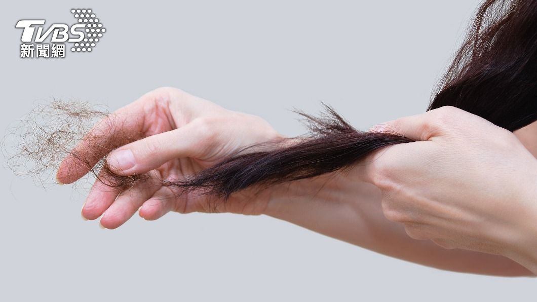 出現掉髮、頭皮乾癢等困擾，關鍵原因可能在於缺乏某一營養素。（示意圖／shutterstock達志影像） 