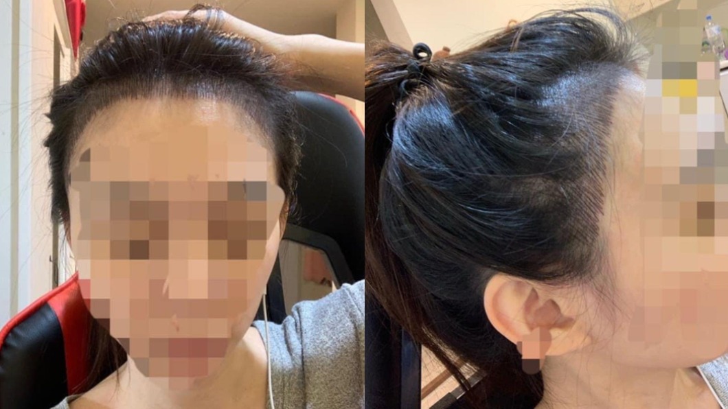 女網友髮際線紋失敗被嘲笑「清朝人」。（圖／翻攝自爆料公社）