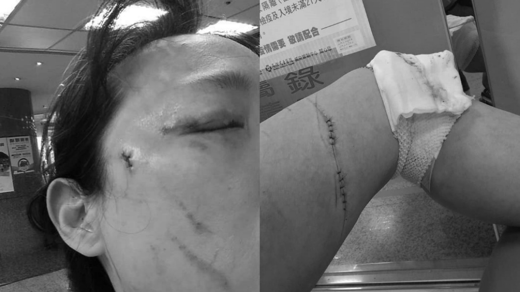 台北市驚傳持刀攻擊、徒手傷眼事件。（圖／翻攝自爆料公社公開版）