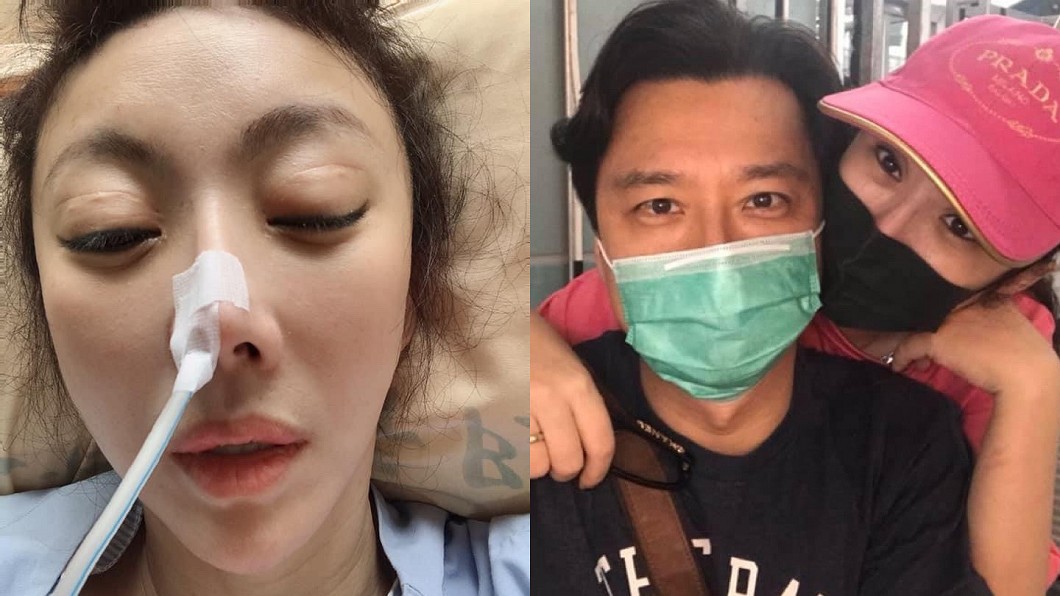李宇柔今年8月就曾在臉書PO出插鼻管照（圖左），這回入院讓老公相當擔憂。（圖／翻攝自李宇柔臉書）