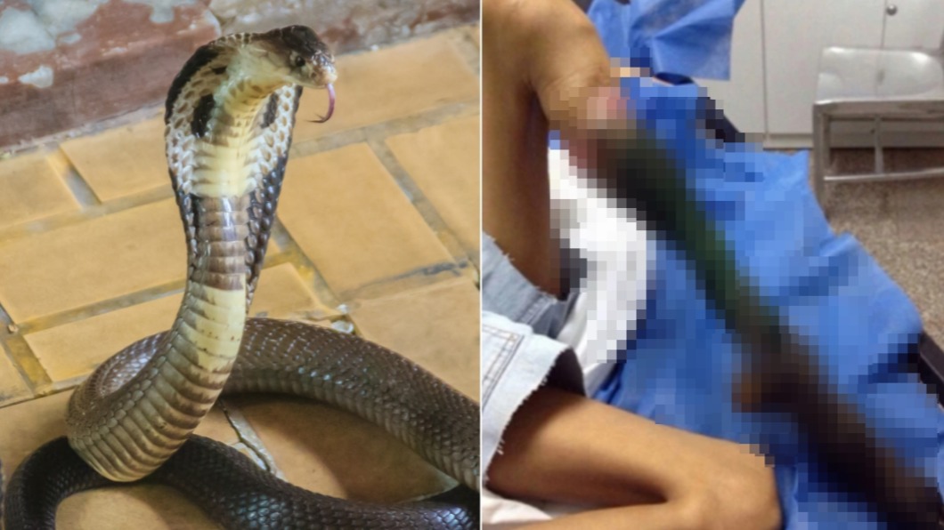 國外屢傳出眼鏡蛇攻擊事件，還有人小腿遭截肢。 （示意圖／shutterstock達志影像、翻攝自Twitter）