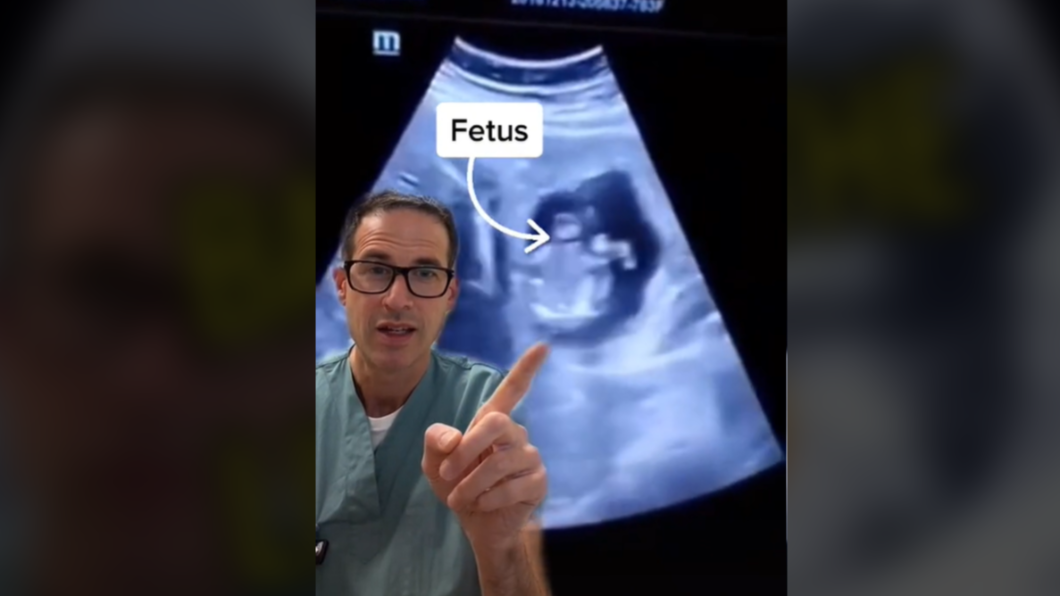 加拿大兒科醫師納維拍影片分享肝臟異位妊娠案例。（圖／翻攝自Dr Michael Narvey TikTok）
