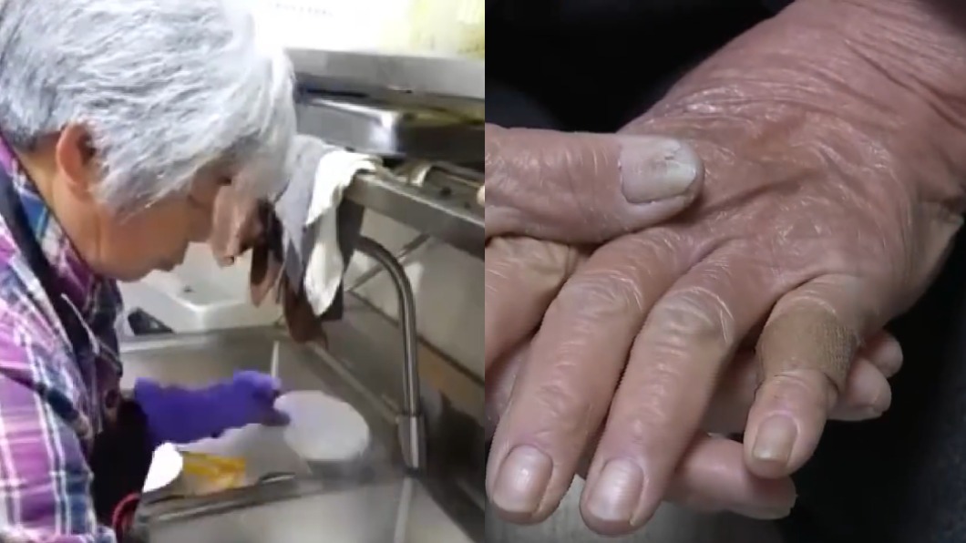 婦人替亡子還債，洗碗10年導致雙手受損。（合成圖／翻攝自荔枝新聞微博）