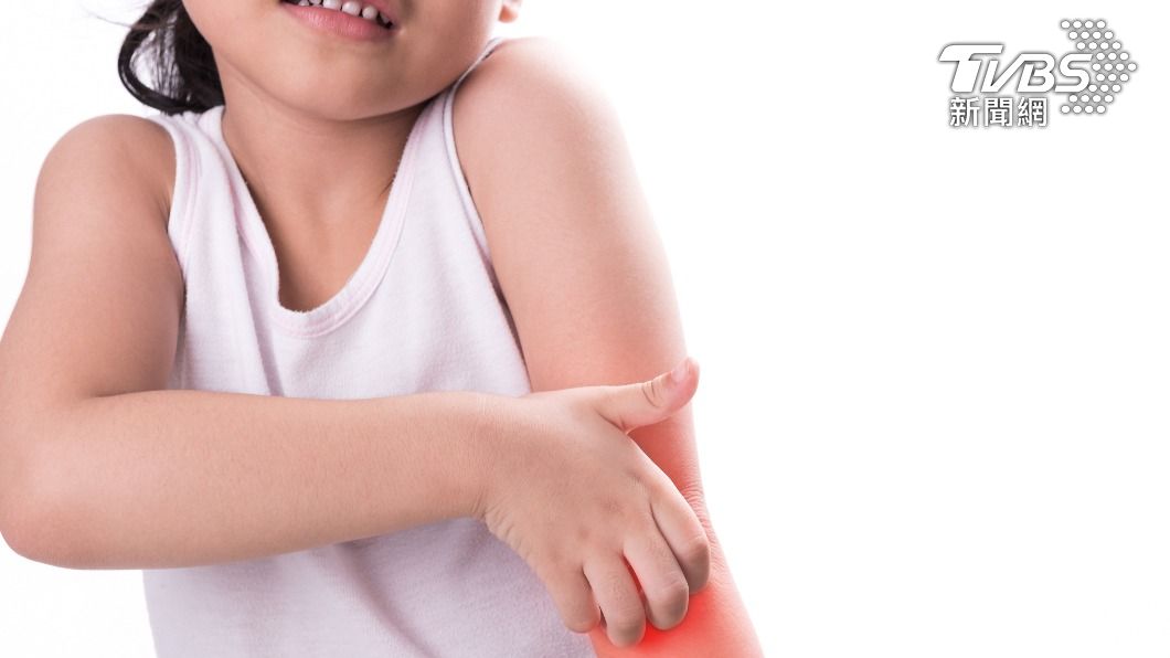 兒童罹患異位性皮膚炎影響大，長期恐傷身又傷心。（示意圖／shutterstock達志影像）