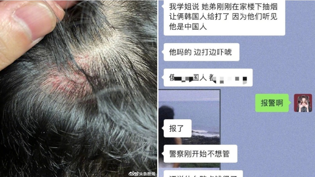 中國大陸留學生在南韓被打的照片在微博上瘋傳。（圖／翻攝自＠头条新闻 微博）