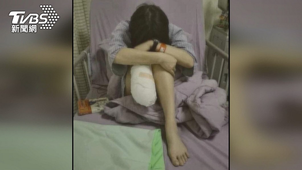 一名女子因職災造成右腳截肢。（圖／TVBS）