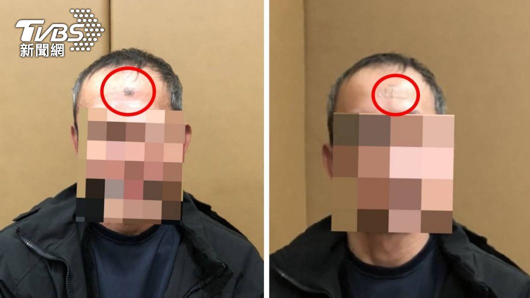 通緝犯額頭上有大黑痣，為了躲避員警還用透氣膠帶貼起來。（圖／TVBS）