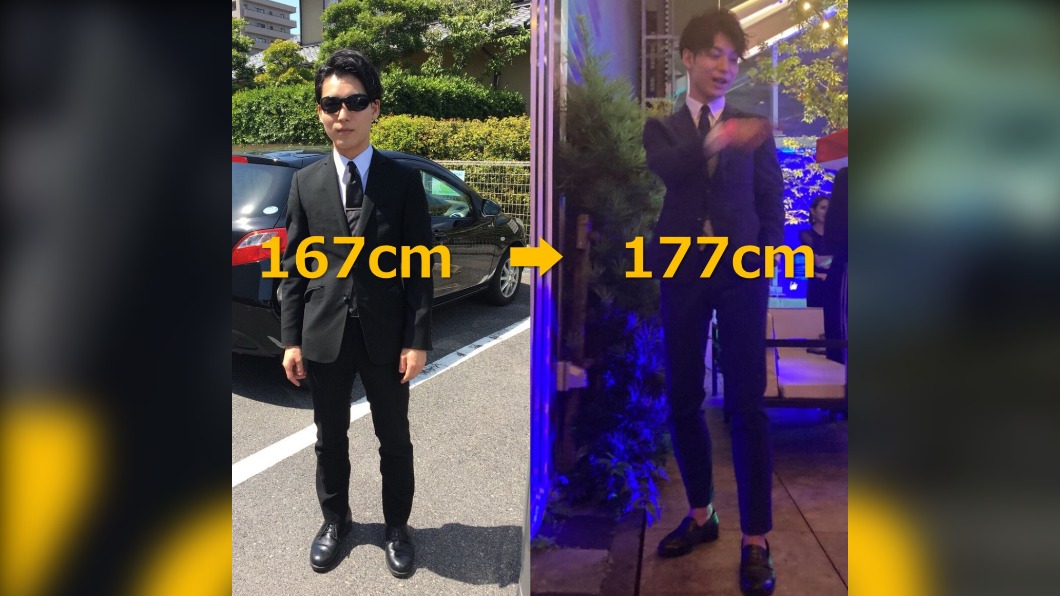 日本型男醫動完手術後增高10公分。（圖／翻攝自@Gen_ilizarov  Twitter）