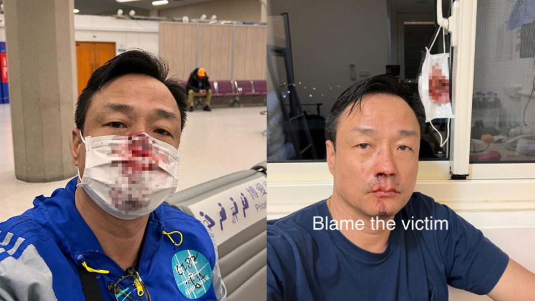 王喜入境台灣進行PCR時意外被捅傷。（圖／翻攝自王喜臉書）