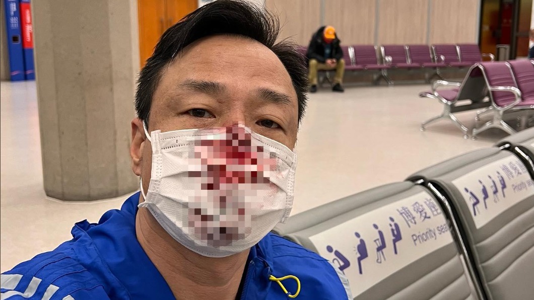 王喜入境台灣進行PCR時意外被捅傷。（圖／翻攝自王喜臉書）