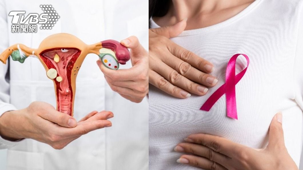 女性10大癌症死因中，乳癌、卵巢癌、子宮頸癌都名列其中。（示意圖，非當事人／shutterstock達志影像）