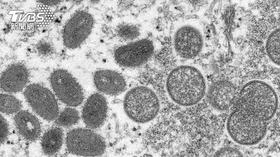 猴痘病毒擴散至中東　以色列、德國通報確診首例