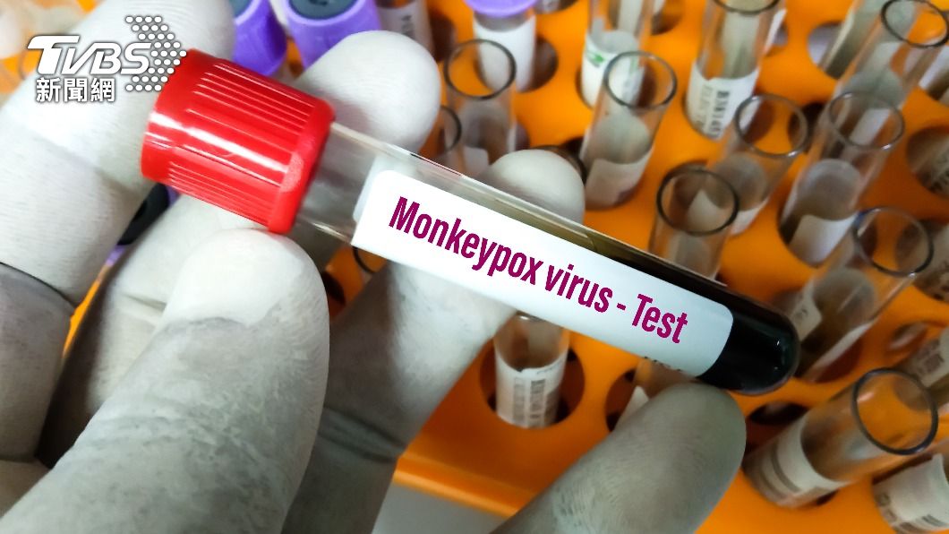 美國衛生官員表示，美國發現兩款猴痘為不同病毒株。（示意圖／shutterstock達志影像）