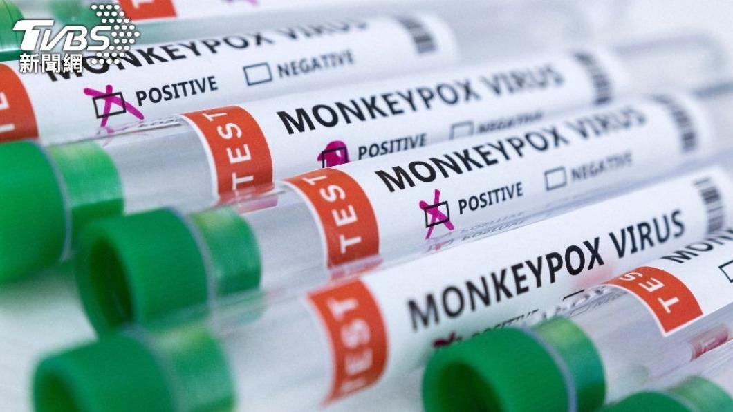 27個非猴痘流行國家共已通報780起病例。（圖／達志影像路透社）