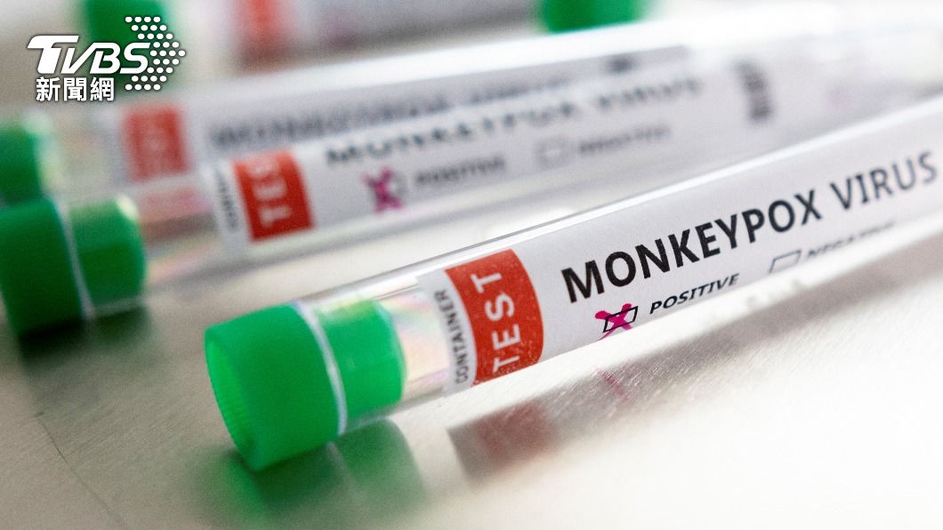 全球非猴痘疫區確診破千，共29國通報病例。（圖／達志影像路透社）