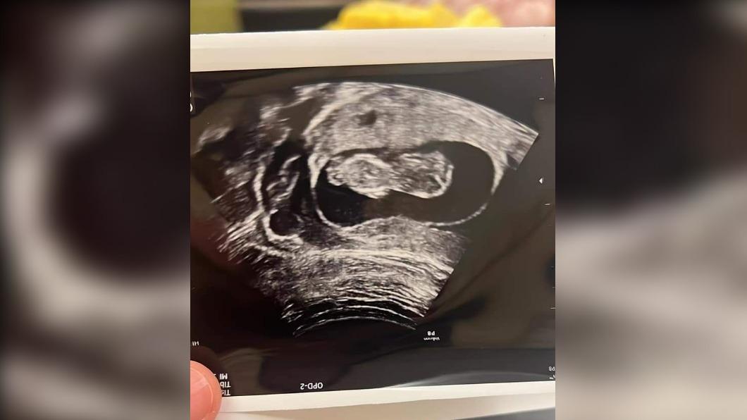 4月初死者才貼出胎兒的超音波照片。（圖／當事人Facebook）