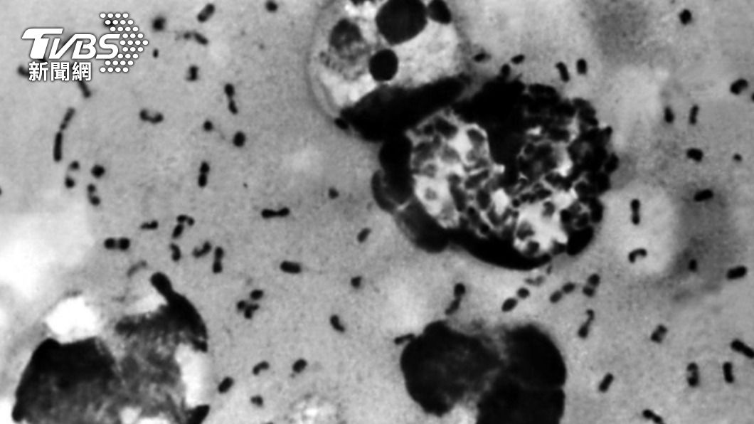 科學家透過鼠疫桿菌比對，發現黑死病源自今天的中亞國家吉爾吉斯。（示意圖／shutterstock 達志影像）