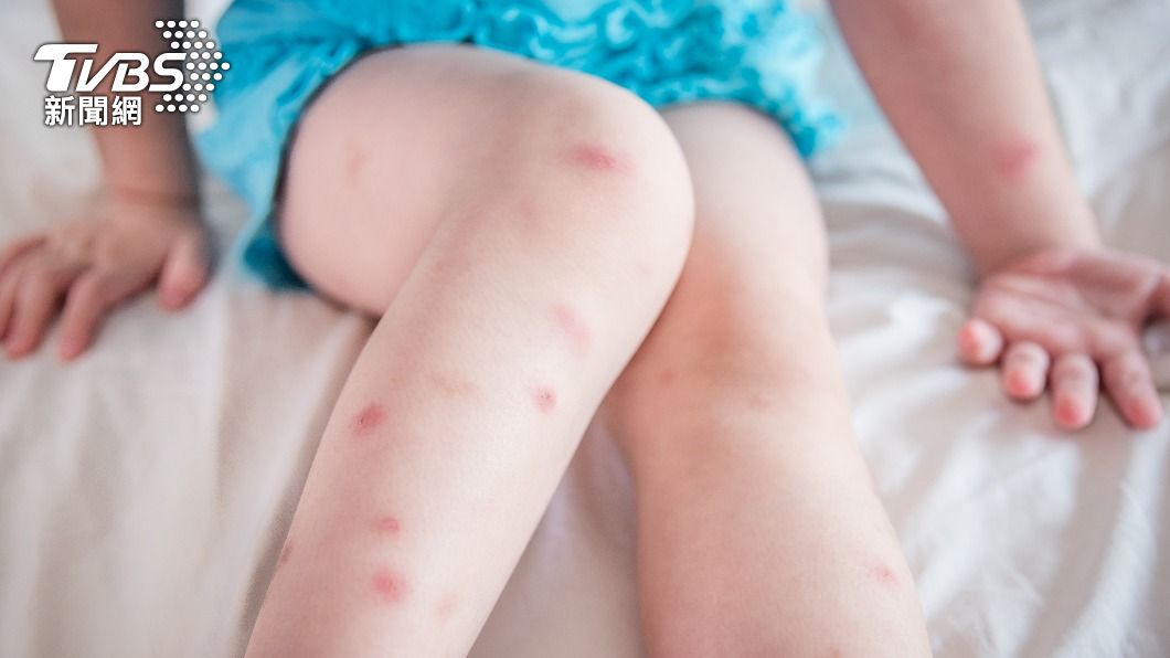 許多家長擔心孩子會遭到蚊子叮咬而被傳染登革熱。（示意圖／shutterstock達志影像）