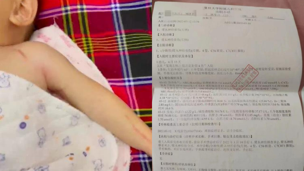 大陸河南一名婦人指控孩子出生時手臂被醫師拉斷導致癱瘓。（圖／翻攝自極目新聞）