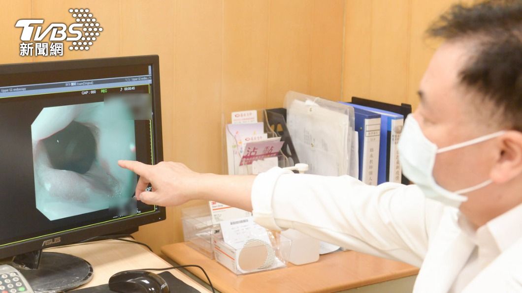 台北慈濟醫院消化外科主任伍超群指出，有患者因長期胃食道逆流，導致橫膈膜出現裂孔。（圖／院方提供）