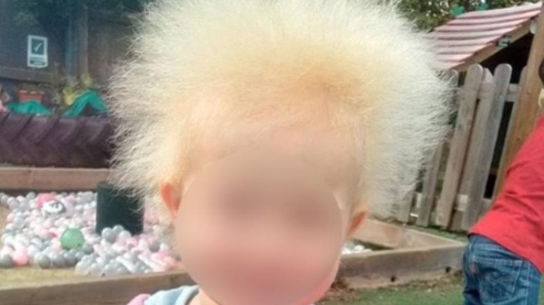 英國女童蕾拉（Layla Davis），罹患罕見「難梳頭髮症候群」（uncombable hair syndrome）。（圖／翻攝自每日郵報）