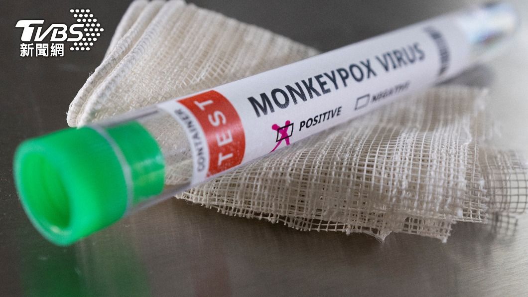 西班牙通報首起與猴痘相關的死亡病例。（圖／達志影像路透社）