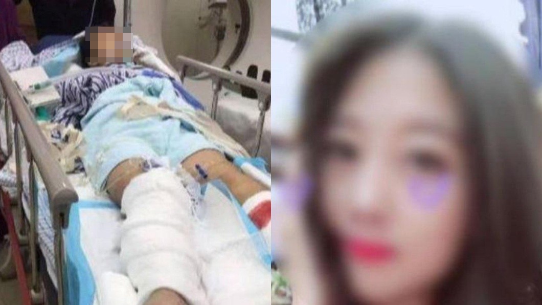 大陸安徽一名正妹相親完畢後遭遇嚴重車禍導致腿部被截肢。（圖／翻攝自網易新聞）