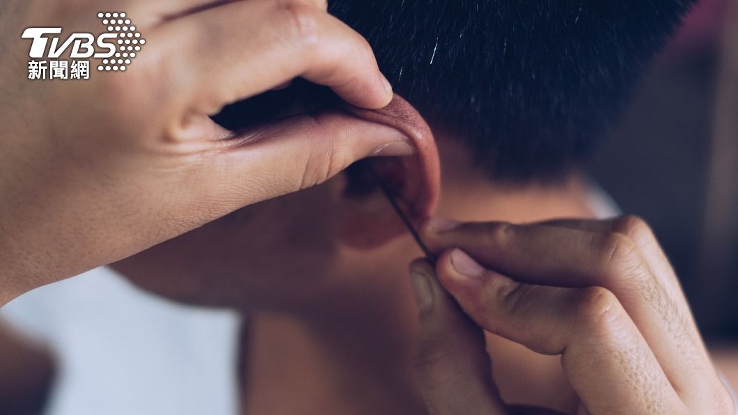 耳垢自己用手挖，不小心可能會造成耳道傷害。（示意圖，非當事人／shutterstock達志影像）