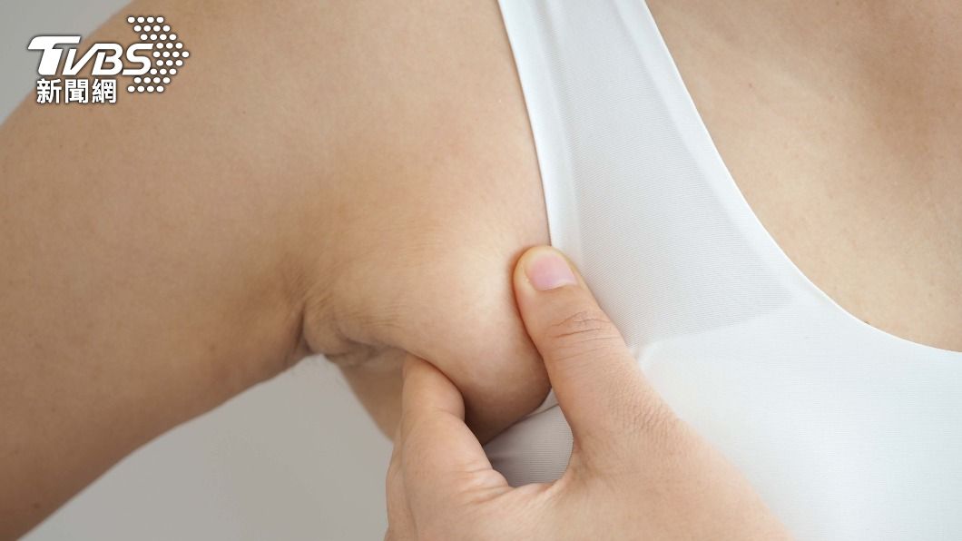 副乳是許多女性穿衣時的困擾。（示意圖，非當事人／shutterstock達志影像）
