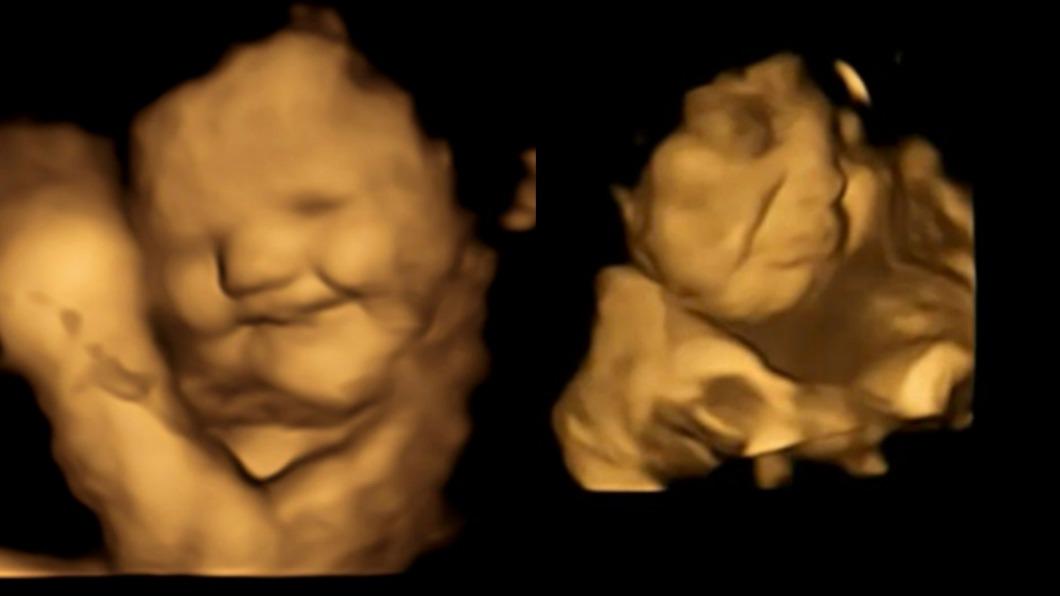 英國最新研究顯示，胎兒會因為母親攝取食物出現表情變化。（圖／翻攝自推特＠profblissett）