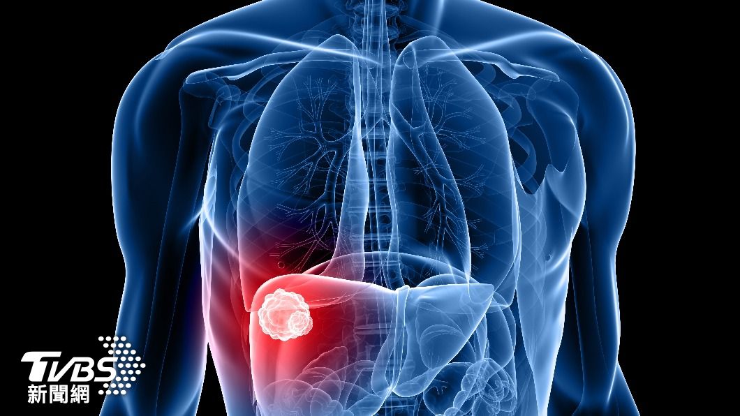 每年超過萬名國人因肝癌死亡。（示意圖／shutterstock 達志影像）