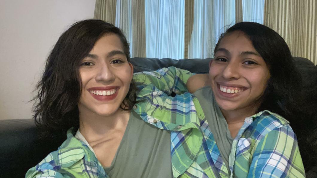 墨西哥一對連體雙胞胎姊妹一出生時胸腔到骨盆就連在一起。（圖／翻攝自推特）