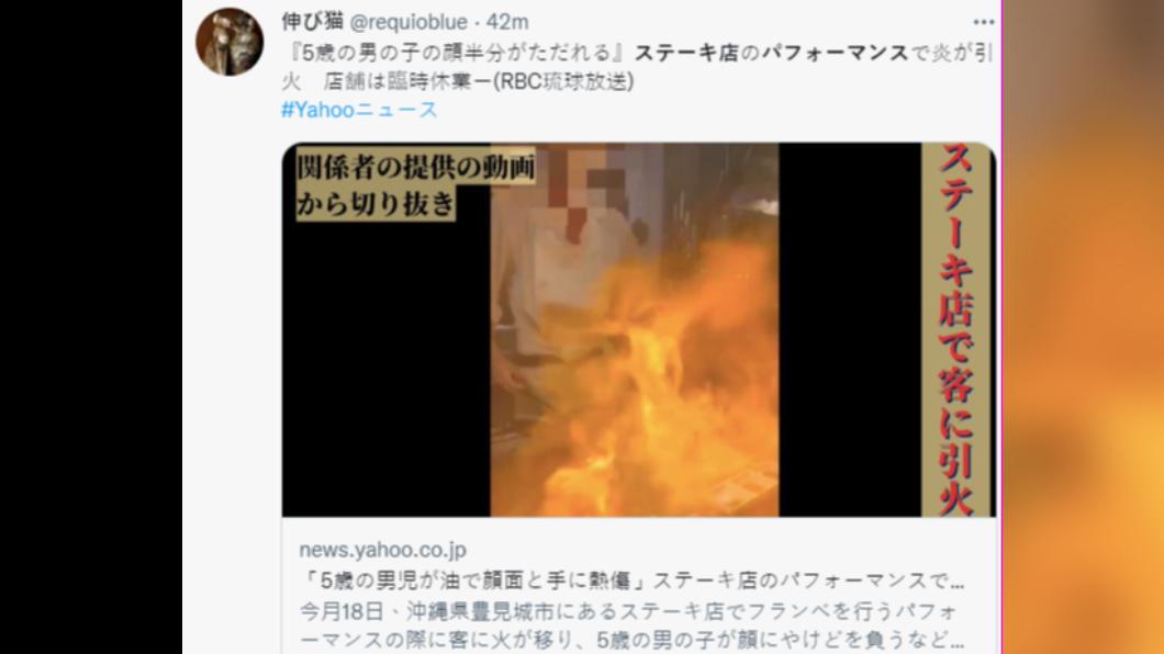 點火秀意外造成男童半張臉灼傷。（圖／翻攝自推特） 嚇！沖繩鐵板燒點火秀驚爆意外　5歲童半張嫩臉慘灼傷