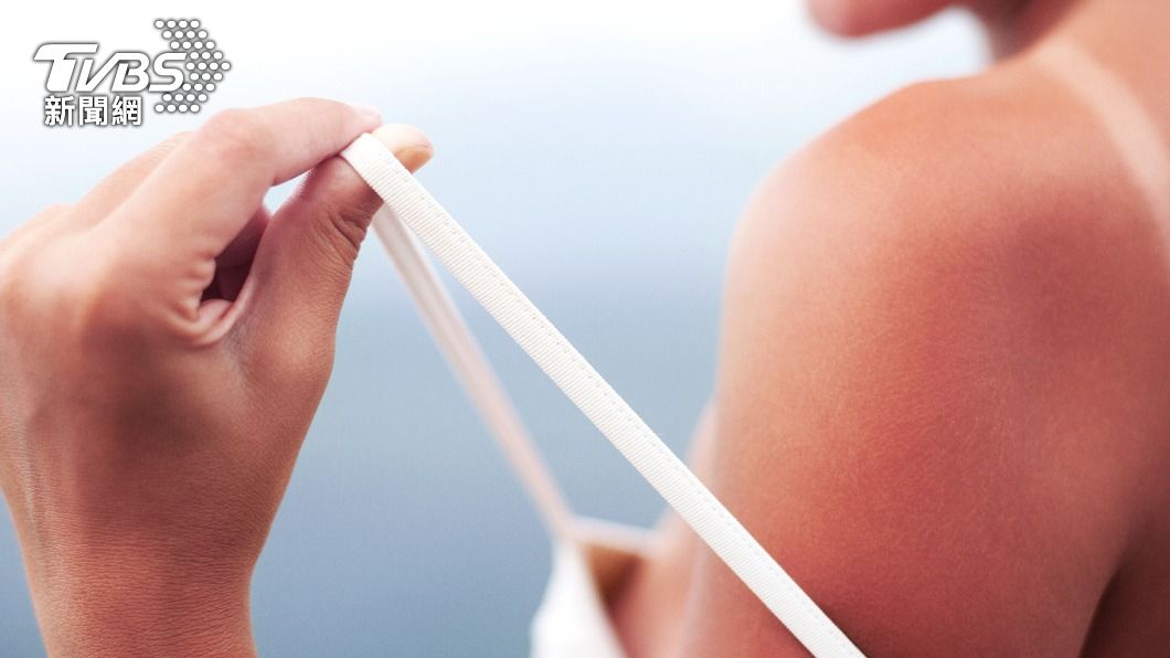 過量的紫外線曝曬容易造成皮膚老化、甚至有致癌風險。（示意圖／Shutterstock達志影像）