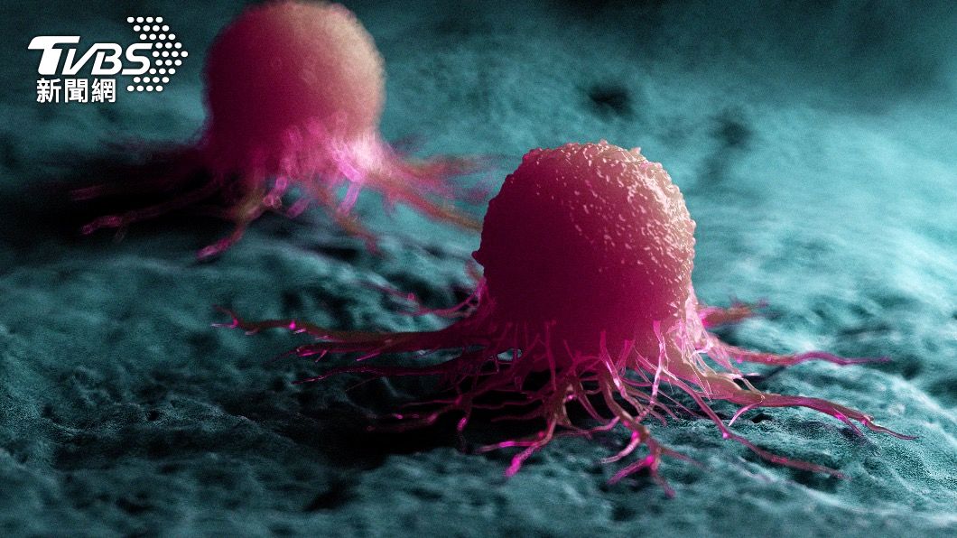 國衛院最新研究發現，癌細胞酸性微環境壓力下得以生長增殖。（示意圖／shutterstock達志影像）