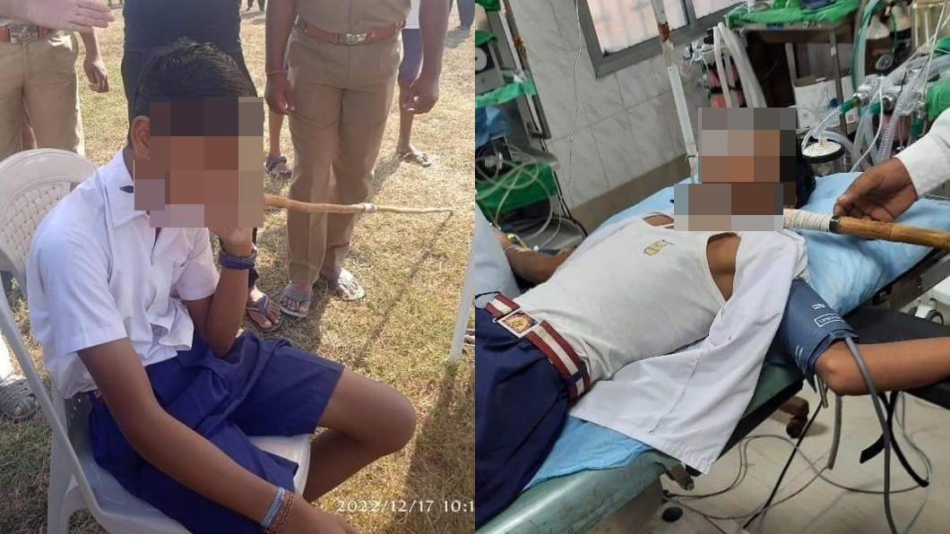 印度一名少年被標槍射穿頸部，竟然一點事情都沒有。（圖／翻攝自推特 Citizen/NAGRIK/Deshwasi/Pranav @pranavkesinga）