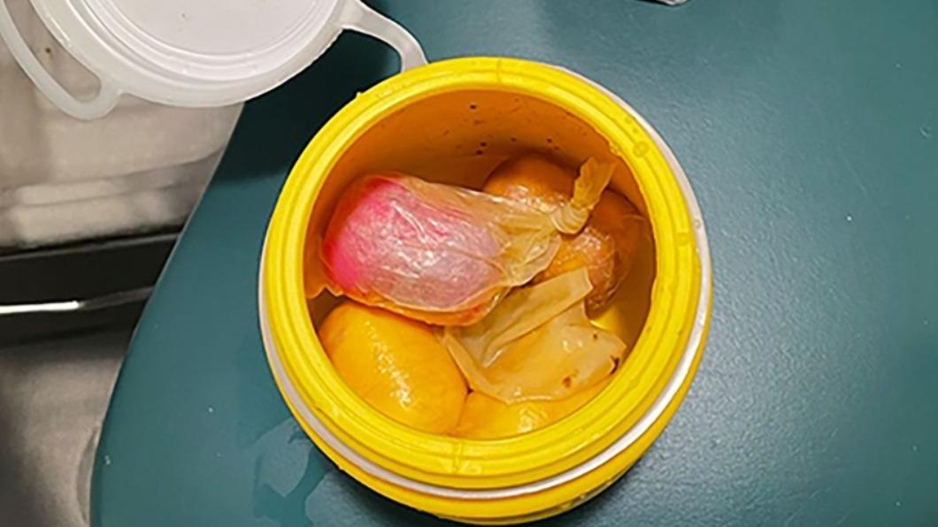 一名28歲愛爾蘭男子將120克重古柯鹼裝進6顆健達出奇蛋（Kinder Surprise）膠囊，再全數「藏於體內」。（圖／翻攝自《CNN》）