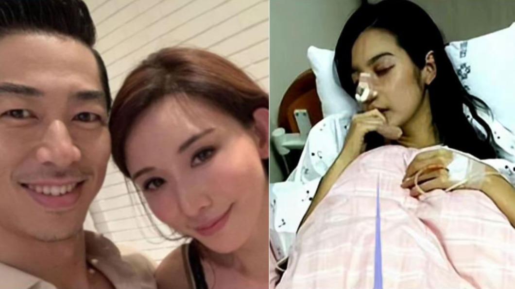 微博掀起「林志玲」家暴傳聞，並曬出受傷照片，但實際上該女為韓國女星李敏英。（圖／翻攝自林志玲IG、微博）