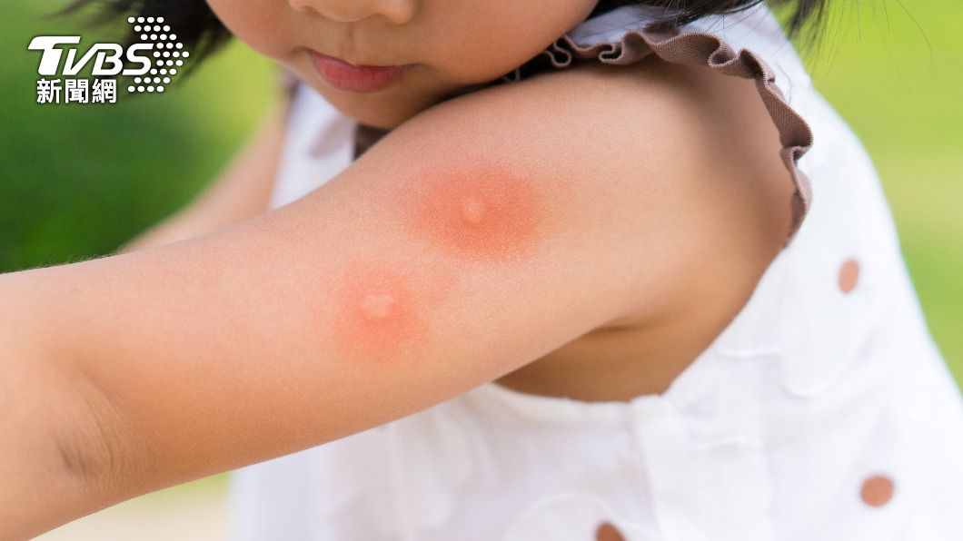 如果蚊蟲藥含有薄荷、樟腦，嬰兒及兩歲以下幼兒最好少用。（示意圖／shutterstock達志影像）