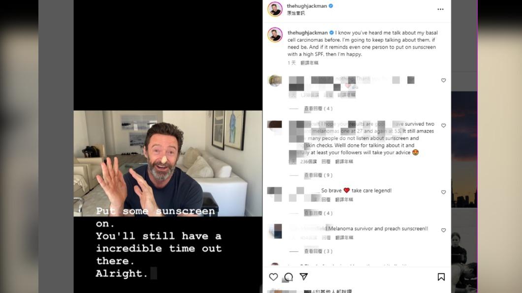 好萊塢影星休傑克曼在IG影片中，提醒粉絲注意防曬、避免和他一樣罹患皮膚癌。（圖／翻攝自休傑克曼Instgram）